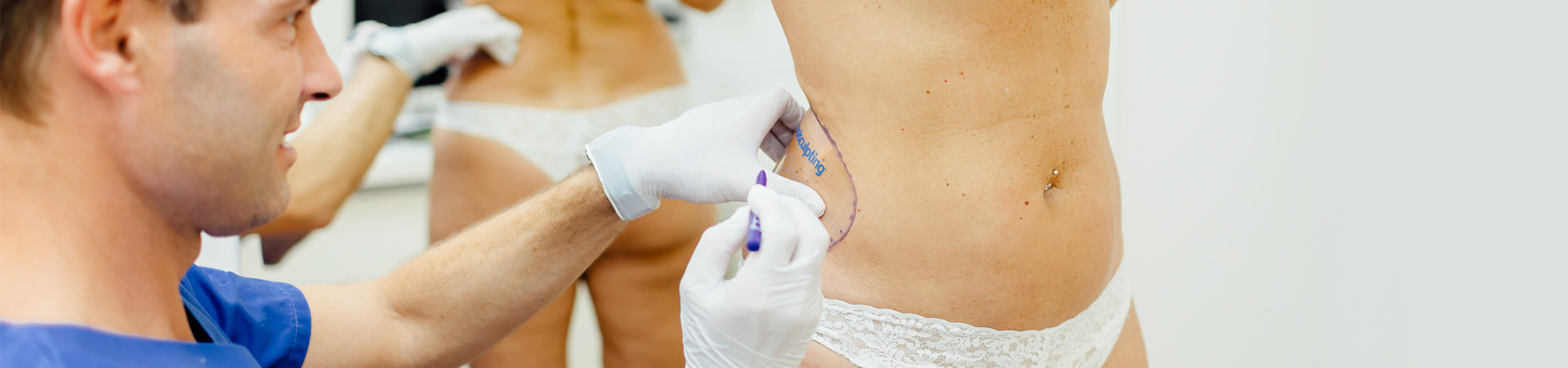 Coolsculpting Wien